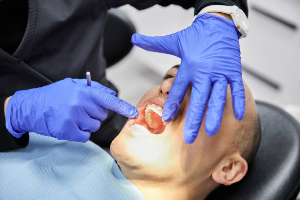 Best Emergency Treatment for Dental Infections or Abscesses in Cambridge, OH