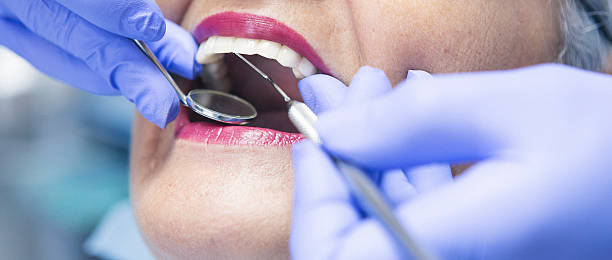 Best Urgent Care for Lost Fillings or Crowns in Cambridge, OH